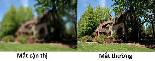 mắt cận thị so với mắt thường