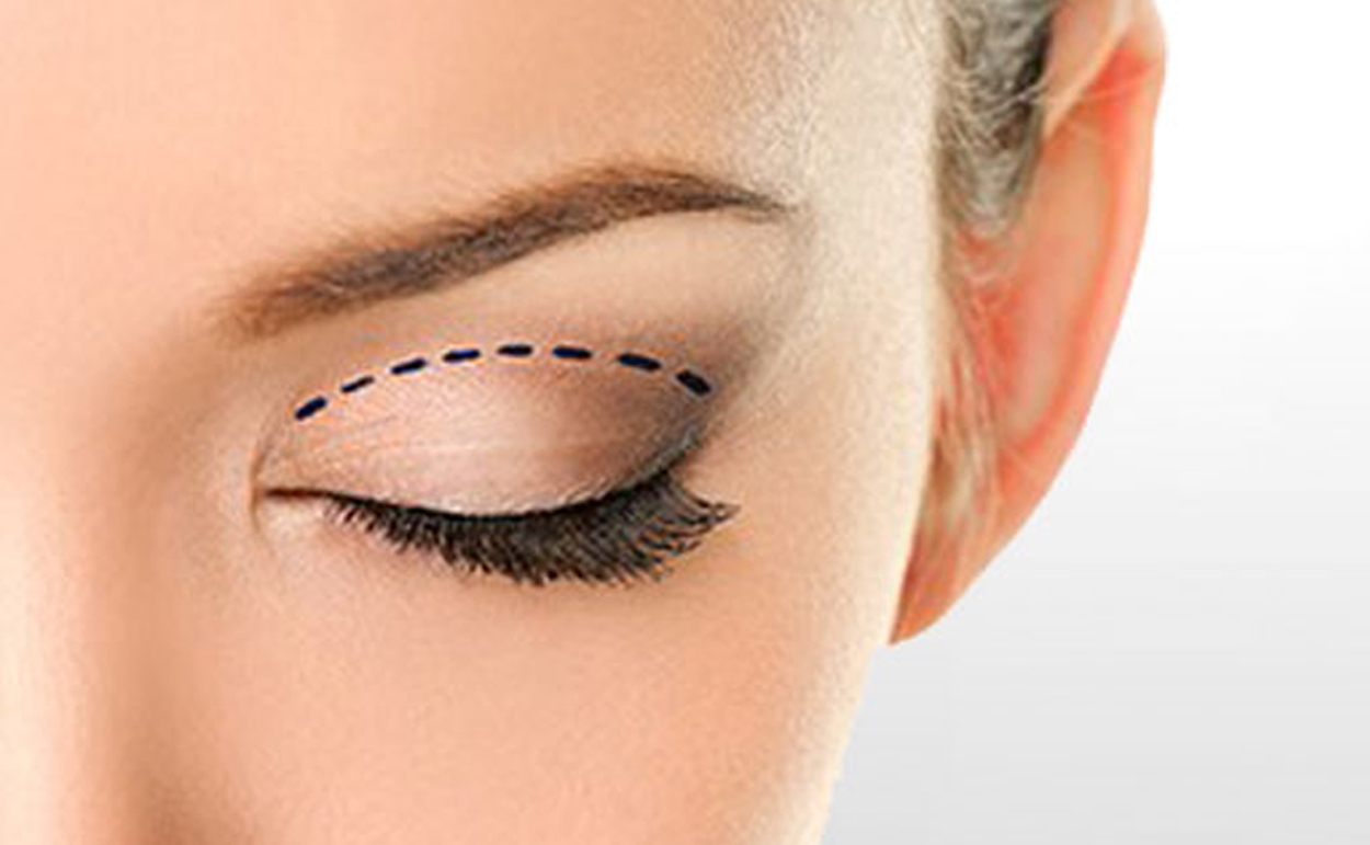 Department of Eye Cosmetic Surgeries